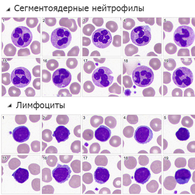 Получите результат