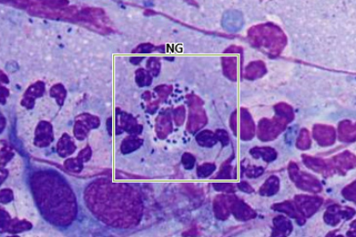 Neisseria gonorrhoeae